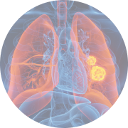 肺イメージ